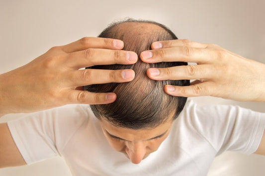 rambut rontok perubahan hormon