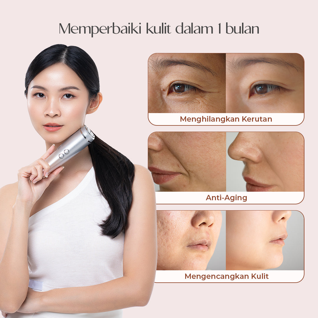 The Splendor Lumin Alat Pengencang Wajah 6in1 | Skin Tightening RF Facial Firming Tool